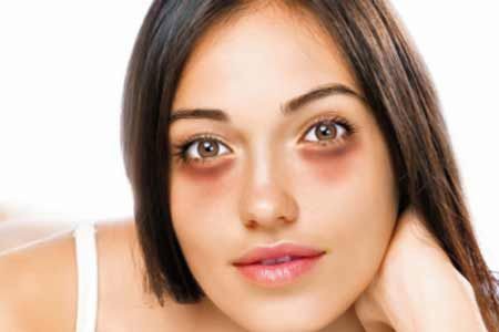 Good home remedies to remove dark spots