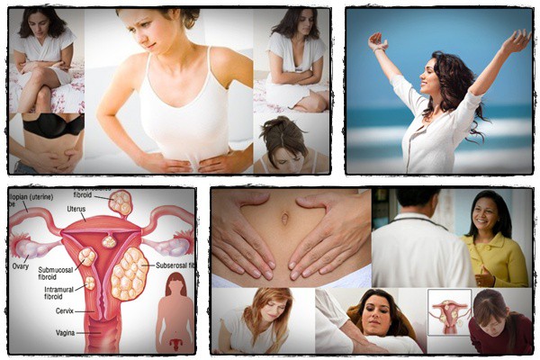 fibroid miracle review