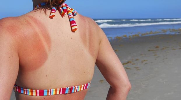 5 Negative Consequences Of Sun Damage And What You Can Do To Protect Yourself
