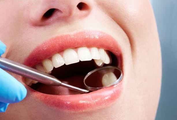 The 3 Best Natural Methods for Preventing Cavities