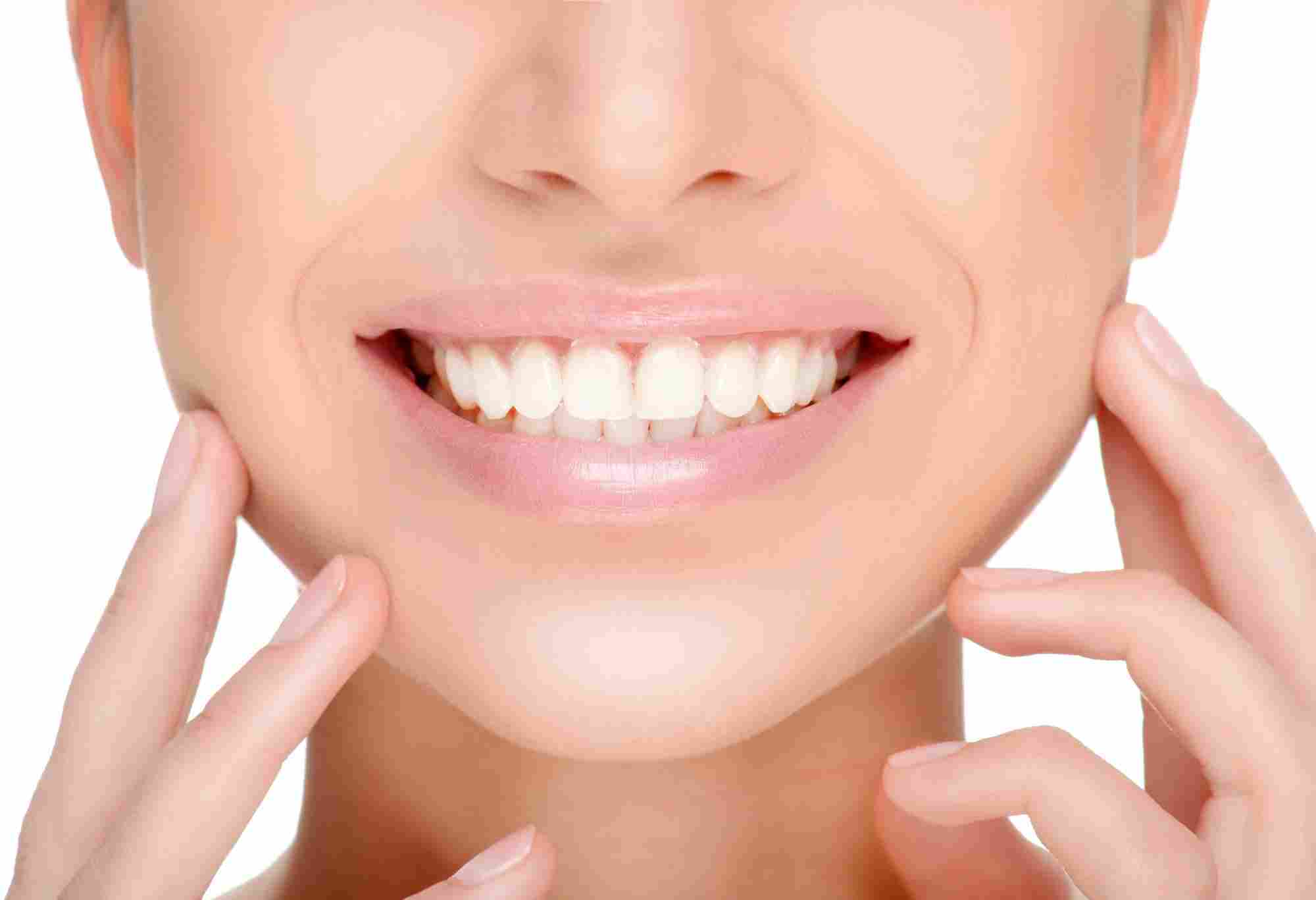 Perfect Smile With Teeth Whitening Treatment
