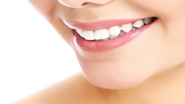 Why White and Healthy Teeth are Essential for your Image