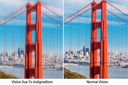 How to Know if You Have Astigmatism and Treatment Options