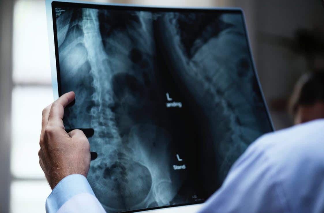 Need a Chest X-Ray? Why Your Doctor’s Recommendations Should be Followed
