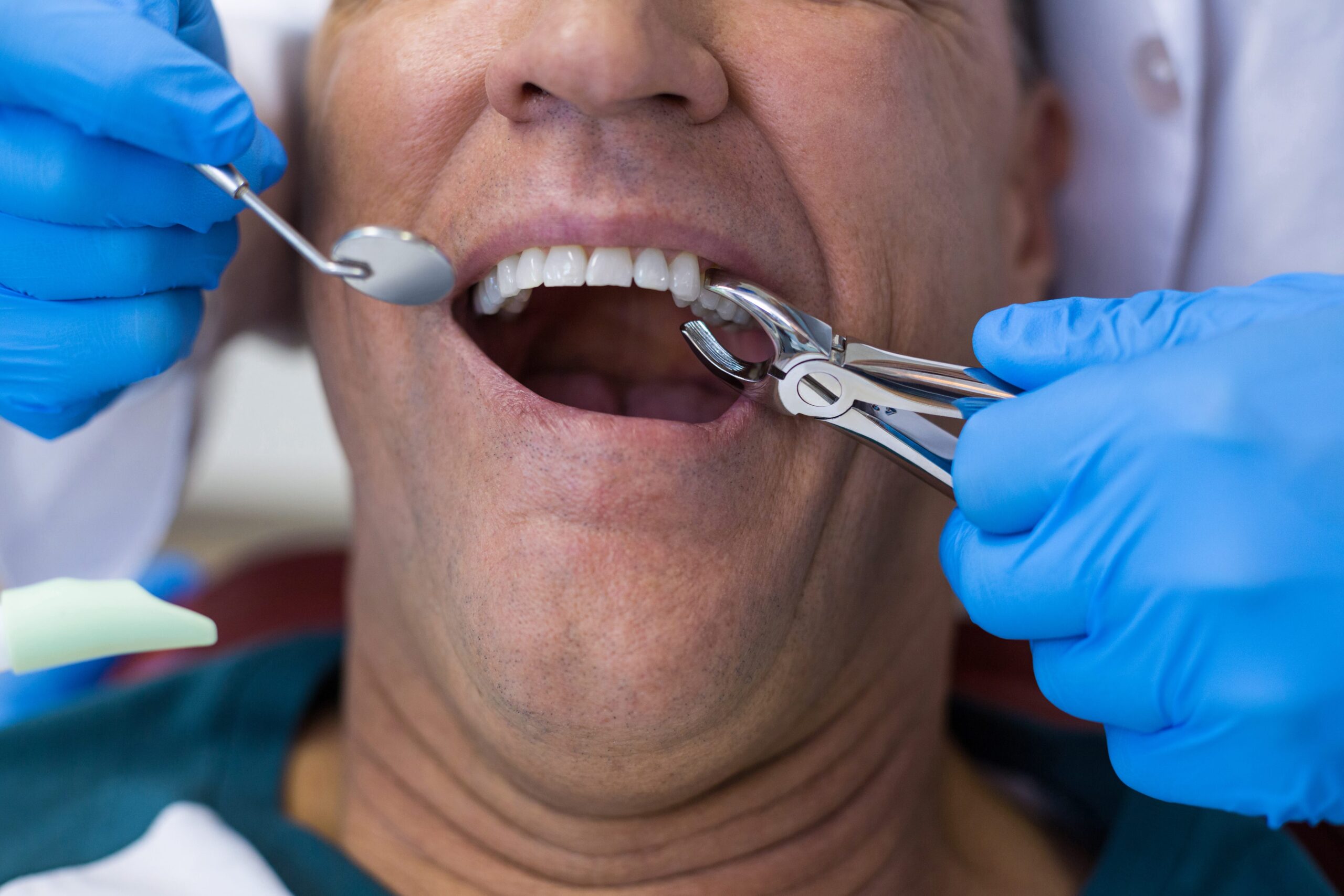 what-to-look-for-when-choosing-an-implant-dentist