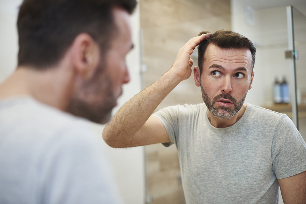 The best treatments for baldness in men